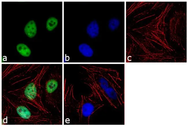 ICC/IF analysis of HeLa cells using GTX80695 KAP1 antibody [20C1]. Panel e is a no primary antibody control. Green : Primary antibody Blue : Nuclei Red : Actin Fixation : 4% paraformaldehyde Permeabilization : 0.1% Triton X-100 for 10 minute Dilution : 2 microg/ml in 0.1% BSA and incubated for 3 hours at room temperature
