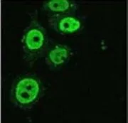 ICC/IF analysis of gamma irradiated HeLa cells using GTX80695 KAP1 antibody [20C1].