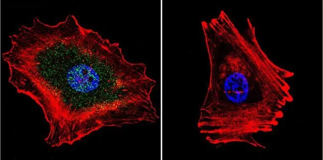 ICC/IF analysis of MCF-7 cells using GTX80698 Progesterone Receptor (phospho Ser294) antibody [608]. Cells were probed without (right) or with(left) an antibody. Green : Primary antibody Blue : Nuclei Red : Actin Fixation : formaldehyde Dilution : 1:20 overnight at 4oC