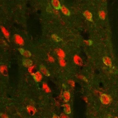 IHC analysis of mouse striatum tissue using GTX80743 Proenkephalin antibody. Green : Primary antibody Red : NeuN