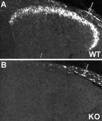 IHC analysis of mouse dorsal root ganglion of wild type (A) and NPY Y2 receptor Knockout (B) animals using GTX80745 NPY2R antibody.
