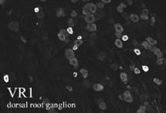 IHC-Fr analysis of rat dorsal root ganglion using GTX80798 VR1/ TRPV1 antibody.