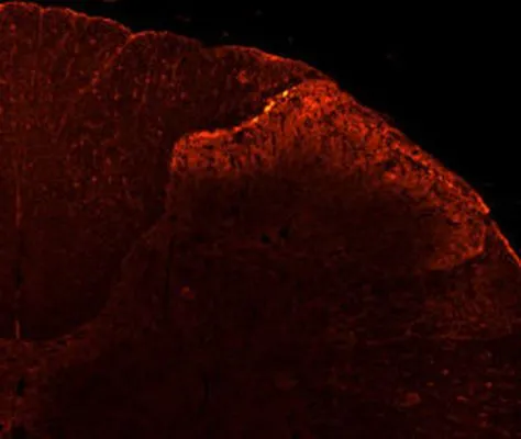 IHC analysis of rat dorsal horn tissue using GTX80798 VR1/ TRPV1 antibody. Dilution : 1:100