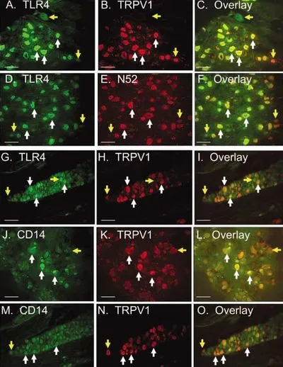 IHC analysis of trigeminal sensory neurons using GTX80798 VR1/ TRPV1 antibody. White arrows depict examples of neurons expressing both markers for each row of three images, and yellow arrows depict examples of neurons that express one but not both markers.