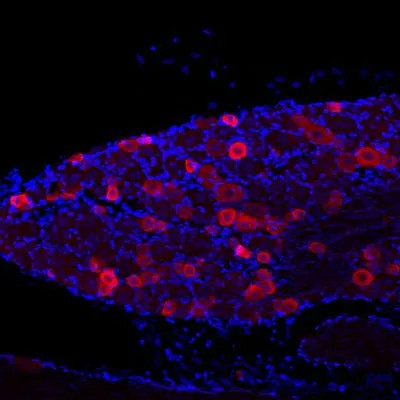 IHC analysis of mouse inferior olive tissue using GTX80798 VR1/ TRPV1 antibody. Red : Primary antibody Blue : DAPI