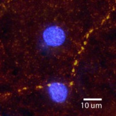 IHC-Fr analysis of rat brain tissue using GTX80804 alpha 2a Adrenergic Receptor antibody. Labeling is confined to synaptic boutons. Red : Primary antibody Blue : DAPI