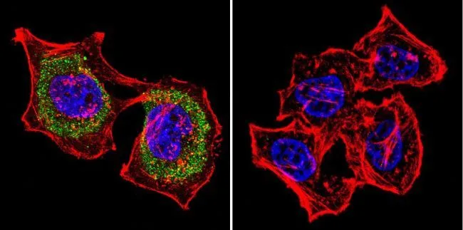 ICC/IF analysis of HeLa cells using GTX80809 Actin antibody [mAbGEa]. Cells were probed without (right) or with(left) an antibody. Green : Primary antibody Blue : Nuclei Red : Actin Fixation : formaldehyde Dilution : 1:20 overnight at 4C