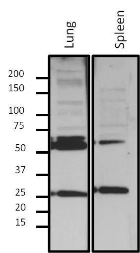 WB analysis of 10microg nuclear extract from fractionated mouse tissue lysate using GTX80813 Lamin A + C antibody [mab636]. Dilution : 1:500
