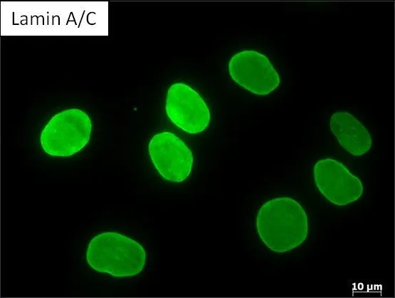 ICC/IF analysis of Human fibroblast cells using GTX80813 Lamin A + C antibody [mab636]. Fixation : methanol Permeabilization : 0.1% Triton X-100 in TBS for 10 minutes Dilution : 1:200 for at least 1 hour at room temperature