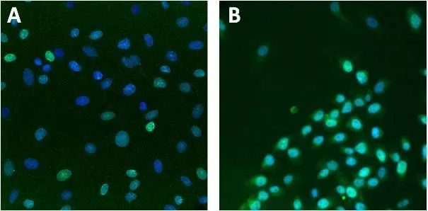 ICC/IF analysis of U2-OS cells (A) or HeLa cells (B) using GTX80813 Lamin A + C antibody [mab636]. Green : Primary antibody Blue : Nuclei Fixation : Formalin Permeabilization : 0.1% Triton X-100 in TBS for 10 minutes Dilution : 1:100 for at least 1 hour at room temperature
