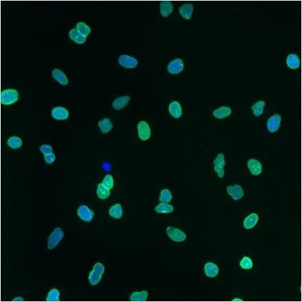 ICC/IF analysis of A549 cells using GTX80813 Lamin A + C antibody [mab636]. Green : Primary antibody Blue : Nuclei
