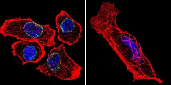 ICC/IF analysis of U251 cells using GTX80813 Lamin A + C antibody [mab636]. Cells were probed without (right) or with(left) an antibody. Green : Primary antibody Blue : Nuclei Red : Actin Fixation : formaldehyde Dilution : 1:200 overnight at 4oC