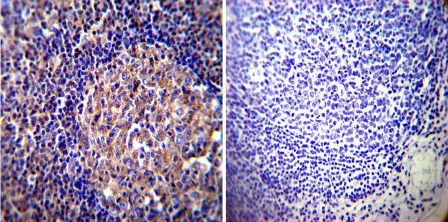 IHC-P analysis of human tonsil tissue using GTX80814 Vimentin antibody [J144]. Left : Primary antibody Right : Negative control without primary antibody Antigen retrieval : heat induced antigen retrieval was performed using 10mM sodium citrate (pH6.0) buffer, microwaved for 8-15 minutes Dilution : 1:1000