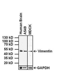WB analysis of 20 ug of indicated whole cell lysates using GTX80814 Vimentin antibody [J144]. Dilution : 1:500