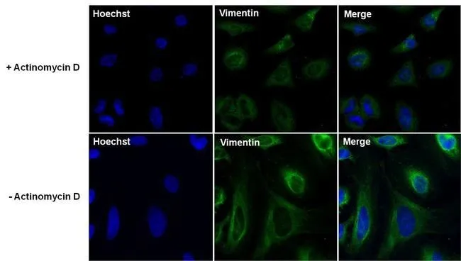 ICC/IF analysis of HeLa cells untreated or treated with 1uM Actinomycin D for 19 hours using GTX80814 Vimentin antibody [J144]. Fixation : 4% paraformaldehyde Permeabilization : 0.1% Triton X-100 for 10 minutes