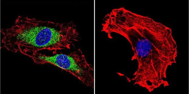 ICC/IF analysis of C6 cells using GTX80814 Vimentin antibody [J144]. Cells were probed without (right) or with(left) an antibody. Green : Primary antibody Blue : Nuclei Red : Actin Fixation : formaldehyde Dilution : 1:200 overnight at 4oC
