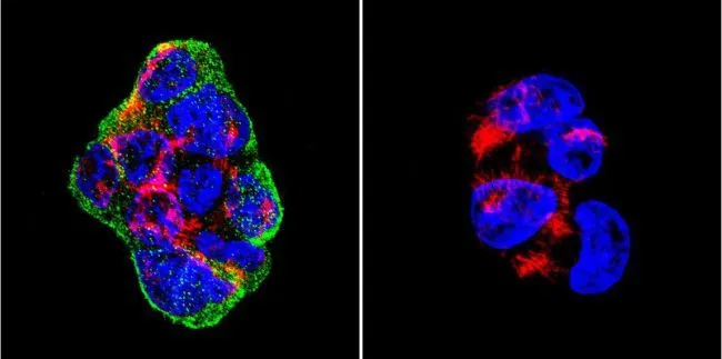 ICC/IF analysis of HEK293 cells using GTX80814 Vimentin antibody [J144]. Cells were probed without (right) or with(left) an antibody. Green : Primary antibody Blue : Nuclei Red : Actin Fixation : formaldehyde Dilution : 1:200 overnight at 4oC