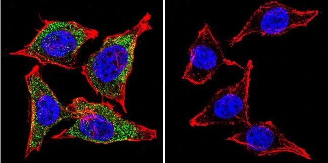 ICC/IF analysis of HeLa cells using GTX80814 Vimentin antibody [J144]. Cells were probed without (right) or with(left) an antibody. Green : Primary antibody Blue : Nuclei Red : Actin Fixation : formaldehyde Dilution : 1:200 overnight at 4oC