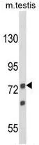 WB analysis of mouse testis tissue lysate (35ug/lane) using GTX80925 ANGEL1 antibody, C-term.