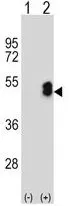 WB analysis of 293 cell lysate (2 ug/lane) either nontransfected (Lane 1) or transiently transfected with the LMX1B (Lane 2) using GTX80930 LMX1B antibody, Internal.
