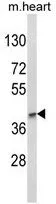 WB analysis of mouse heart tissue lysate (35ug/lane) using GTX80930 LMX1B antibody, Internal.