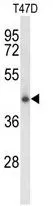 WB analysis of T47D cell lysate (35ug/lane) using GTX80945 CLN5 antibody, N-term.