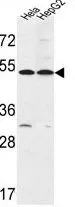 WB analysis of HeLa, HepG2 cell lysate (35ug/lane) using GTX80946 FERMT1 antibody, Internal.