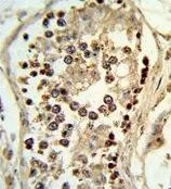 IHC-P analysis of human testis tissue using GTX80950 ABHD12 antibody, N-term.