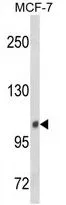WB analysis of MCF-7 cell lysate (35ug/lane) using GTX80952 INPP4B antibody, Internal.