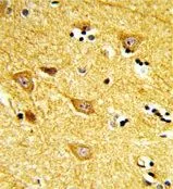IHC-P analysis of human brain tissue using GTX80952 INPP4B antibody, Internal.