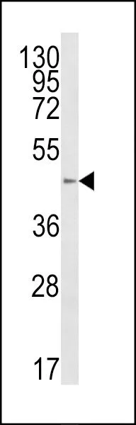 WB analysis of HL-60 cell lysate (35ug/lane) using GTX80958 B4GalT1 antibody, C-term.