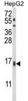 WB analysis of HepG2 cell lysate (35ug/lane) using GTX80967 MGST2 antibody, C-term.