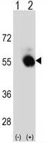 WB analysis of 293 cell lysate (2 ug/lane) either nontransfected (Lane 1) or transiently transfected with the SELENBP1 (Lane 2) using GTX80973 SELENBP1 antibody, C-term.