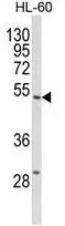 WB analysis of HL-60 cell lysate (35ug/lane) using GTX80973 SELENBP1 antibody, C-term.