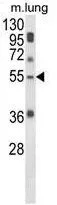 WB analysis of mouse lung tissue lysate (35ug/lane) using GTX80973 SELENBP1 antibody, C-term.