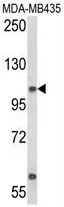 WB analysis of MDA-MB435 cell lysate (35ug/lane) using GTX80980 CASD1 antibody, N-term.