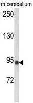 WB analysis of mouse cerebellum tissue lysate (35ug/lane) using GTX80980 CASD1 antibody, N-term.