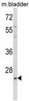WB analysis of mouse bladder tissue lysate (35ug/lane) using GTX80982 KLF16 antibody, Internal.