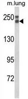 WB analysis of mouse lung tissue lysate (35ug/lane) using GTX80984 COL18A1 antibody, N-term.