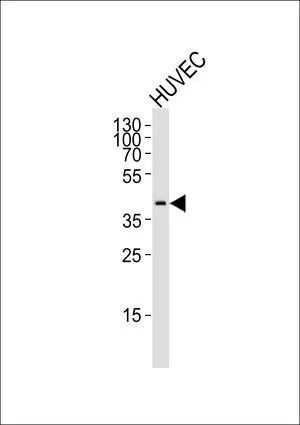 WB analysis of HUVEC cell lysate using GTX80987 OLR1 / LOX-1 antibody, Internal. Loading : 35ug Dilution : 1:1000