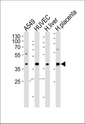 WB analysis of A549, HUVEC cell, human liver, placenta tissue lysate using GTX80987 OLR1 / LOX-1 antibody, Internal. Loading : 35ug per lane Dilution : 1:1000