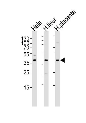 WB analysis of HeLa cell , human liver, and placenta tissue lysate using GTX80987 OLR1 / LOX-1 antibody, Internal. Loading : 35ug per lane Dilution : 1:1000