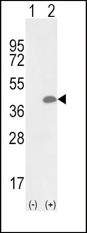 WB analysis of 293 cell lysate (2 ug/lane) either nontransfected (Lane 1) or transiently transfected with the OLR1 (Lane 2) using GTX80987 OLR1 / LOX-1 antibody, Internal.