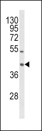 WB analysis of HL-60 cell lysate (35ug/lane) using GTX80987 OLR1 / LOX-1 antibody, Internal.