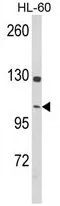 WB analysis of HL-60 cell lysate (35ug/lane) using GTX80993 Dynamin 3 antibody, Internal.