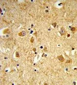 IHC-P analysis of human brain tissue using GTX80993 Dynamin 3 antibody, Internal.