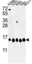 WB analysis of A2058, A375, K562, HeLa, MCF-7 cell lysate (35ug/lane) using GTX81004 Histone H2A type 1H antibody, N-term.