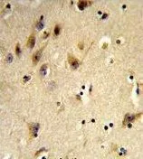 IHC-P analysis of human brain tissue using GTX81004 Histone H2A type 1H antibody, N-term.