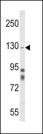 WB analysis of mouse cerebellum tissue lysate (35ug/lane) using GTX81008 Integrin alpha 1 antibody, Internal.