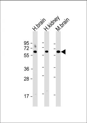 WB analysis of various samples using GTX81012 GLS antibody, C-term. Lane 1: human brain lysate Lane 2: human kidney lysate Lane 3: mouse brain lysate Loading : 20 microg per lane Dilution : 1:2000